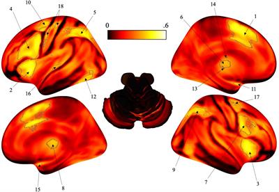 Selectivity of timing: A meta-analysis of temporal processing in neuroimaging studies using activation likelihood estimation and reverse inference